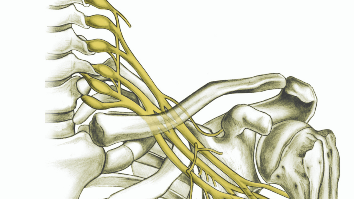 Plexus brachial nerve nerves traumatic injuries hughston muscles